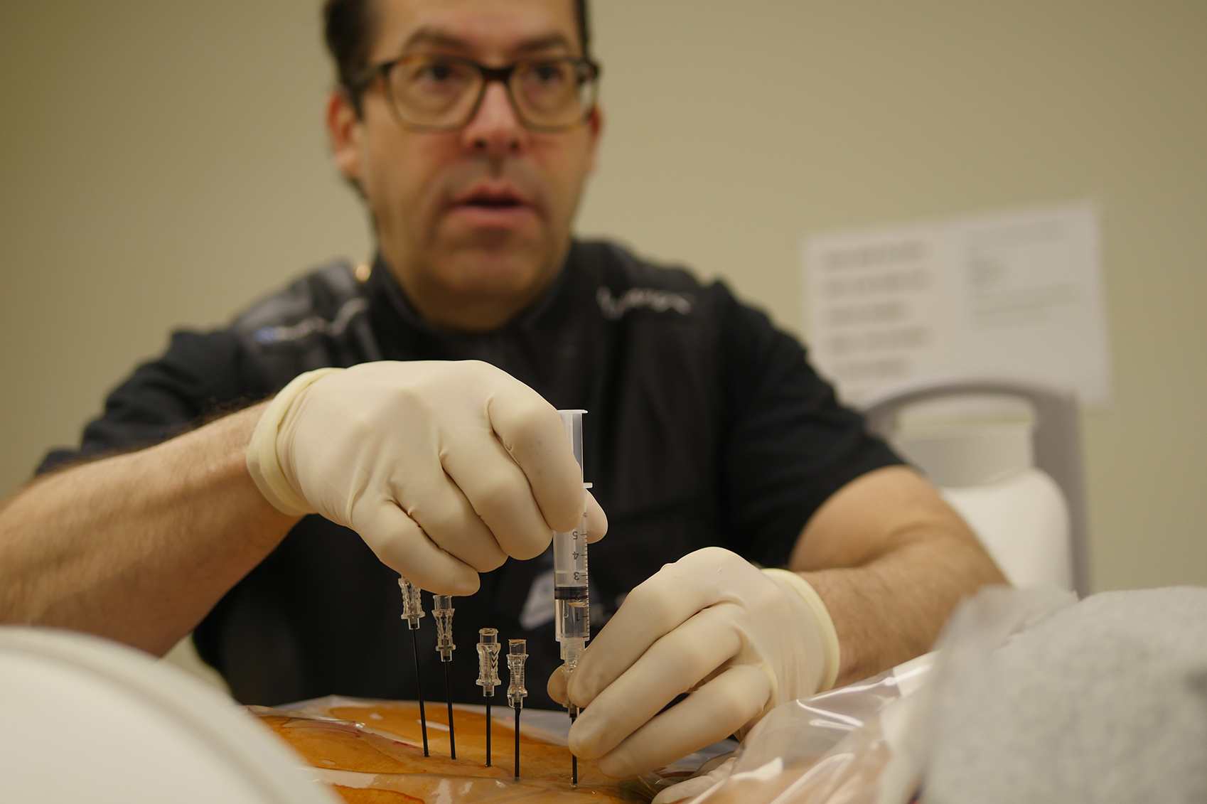 Dr_Sturm_Ablation Radiofrequency Ablation 2