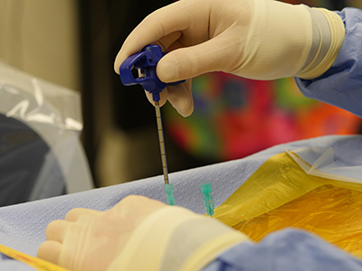 Kyphoplasty6