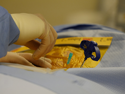Kyphoplasty8