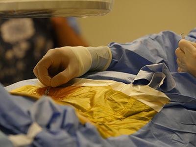 navigating-SCS-lead-along-spine
