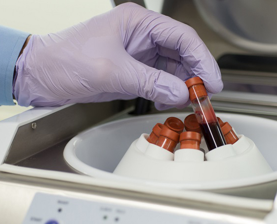 platelet-rich-plasma-centrifuge PRP Injection Centrifuge