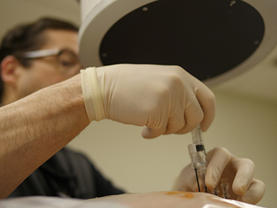 radio_frequency_ablation_7 Radiofrequency Ablation 9