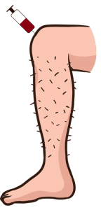 Stem Cell Injection Stem Cell Injection
