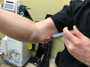Dr. Sturm PRP Injection PRP Injection