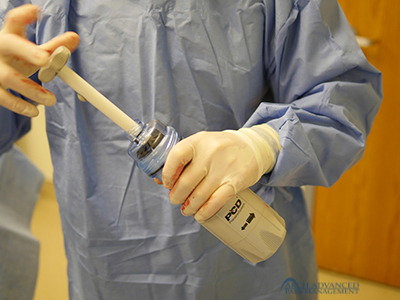 Kyphoplasty Compression Fractures