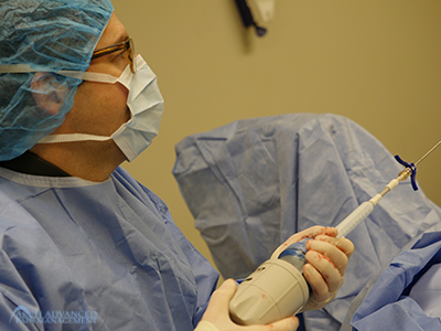 Kyphoplasty Compression Fractures