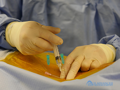 Kyphoplasty Compression Fractures