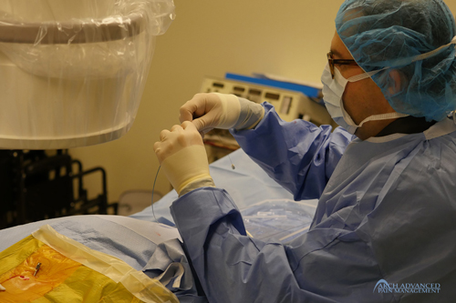 Spinal Cord Stimulation - Dr. Sturm High Frequency Spinal Cord Stimulation
