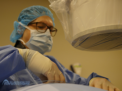 begining-SCS-trial-procedure High-Frequency Spinal Cord Stimulation