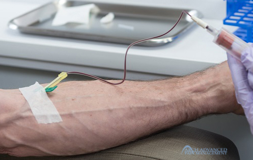 platelet-rich-plasma-collection PRP Injection Arch Advanced Pain Management