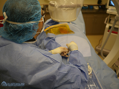 positioning-electrode High-Frequency Spinal Cord Stimulation